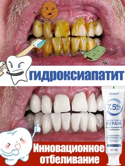 Отбеливающая зубная паста, укрепление эмали зубов, 120 г LYDIMOON 412026501 купить за 1 041 ₽ в интернет‑магазине Wildberries